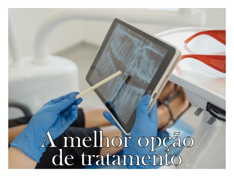 a melhor opção de tratamento odontologico