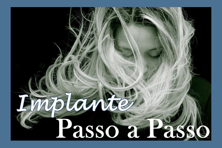 O implante passo a passo